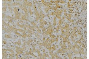 ABIN6272963 at 1/100 staining Mouse liver tissue by IHC-P. (LONP1 anticorps  (C-Term))