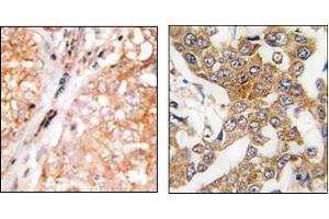 Image no. 1 for anti-BCL2-Like 2 (BCL2L2) (AA 1-100), (BH3 Domain), (N-Term) antibody (ABIN356814)