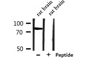 Western blot analysis of extracts from rat brain, using SLC6A17 Antibody.
