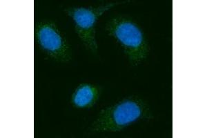 IF analysis of AGPS using anti-AGPS antibody (ABIN7600146). (AGPS anticorps  (AA 154-658))