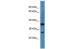 WB Suggested Anti-Cacng1 Antibody Titration: 0. (CACNG1 anticorps  (N-Term))