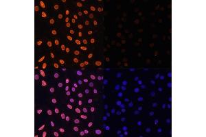 Immunofluorescence analysis of C6 cells using Acetyl-Histone H3-K36 antibody (ABIN7267671) at dilution of 1:100.