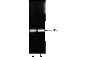 Western blot analysis of Proteasome 19S ATPase subunit Rpt6, mAb (p45-110) . (Proteasome 19S Rpt6/S8 Subunit anticorps)