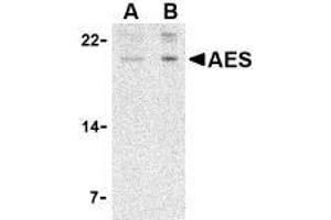 Western blot analysis of AES in 293 cell lysate with AES antibody at (A) 2 and (B) 4 μg/ml. (AES anticorps  (N-Term))