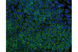 IF analysis of Tryptophan Hydroxylase/TPH1 using anti-Tryptophan Hydroxylase/TPH1 antibody (ABIN7601556).
