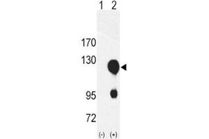 Western blot analysis of ROR2 antibody and 293 cell lysate either nontransfected (Lane 1) or transiently transfected with the ROR2 gene (2).