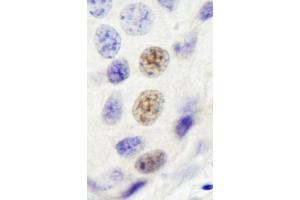 anti-Integrator Complex Subunit 4 (INTS4) (AA 913-963) antibody