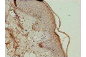 Immunohistochemistry of paraffin-embedded human skin tissue using ABIN7173433 at dilution of 1:100