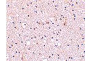 Immunohistochemistry of NCSTN in human brain tissue with NCSTN polyclonal antibody  at 2.