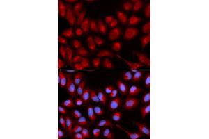 Immunofluorescence analysis of U2OS cell using IL16 antibody.