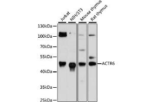 Western blot analysis of extracts of various cell lines, using  antibody (ABIN6133271, ABIN6136499, ABIN6136500 and ABIN6217149) at 1:3000 dilution. (ACTR6 anticorps  (AA 237-396))