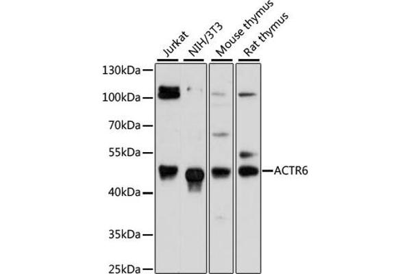 ACTR6 Antikörper  (AA 237-396)