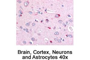 Image no. 1 for anti-Niemann-Pick Disease, Type C1 (NPC1) (C-Term) antibody (ABIN363474)