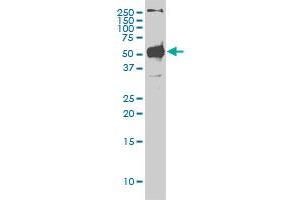 STK38 monoclonal antibody (M01A), clone 2G8-1F3 Western Blot analysis of STK38 expression in Hela S3 NE . (STK38 anticorps  (AA 1-465))