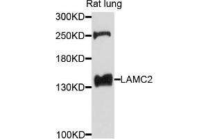 Western blot analysis of extracts of rat lung cells, using LAMC2 antibody. (LAMC2 anticorps)