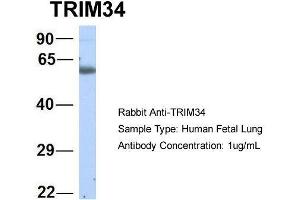 Host:  Rabbit  Target Name:  TRIM34  Sample Type:  Human Fetal Lung  Antibody Dilution:  1. (TRIM34 anticorps  (N-Term))