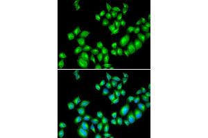 Immunofluorescence analysis of U20S cell using DRD3 antibody. (DRD3 anticorps  (AA 213-329))