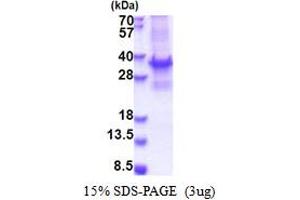 SDS-PAGE (SDS) image for Breast Cancer Metastasis Suppressor 1 (BRMS1) (AA 1-246) protein (T7 tag) (ABIN6387359)