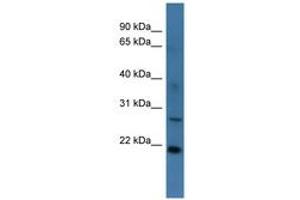 Image no. 1 for anti-StAR-Related Lipid Transfer (START) Domain Containing 4 (STARD4) (AA 96-145) antibody (ABIN6746357) (STARD4 anticorps  (AA 96-145))
