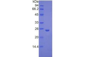 SDS-PAGE analysis of Mouse Glypican 4 Protein. (GPC4 Protéine)