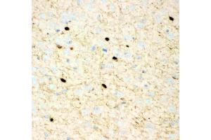 Anti- Calretinin Picoband antibody, IHC(P): Mouse Brain Tissue