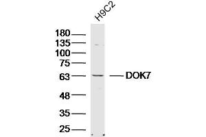 Lane 1: H9C2 lysates probed with DOK7 Polyclonal Antibody, Unconjugated  at 1:300 overnight at 4˚C. (DOK7 anticorps  (AA 21-120))