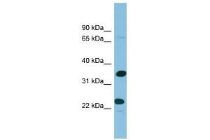 Prodynorphin antibody used at 1 ug/ml to detect target protein. (PDYN anticorps  (Middle Region))