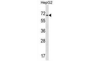 ACCN4 Antibody (ACCN4 anticorps  (N-Term))