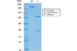 SDS-PAGE Analysis Purified E-Cadherin Mouse Recombinant Monoclonal Ab (rCDH1/1525).