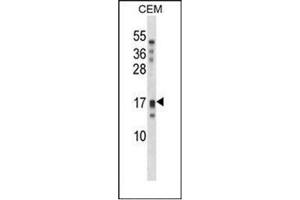 Western blot analysis of KLK15 / Kallikrein-15 Antibody (Center) in CEM cell line lysates (35ug/lane). (Kallikrein 15 anticorps  (Middle Region))