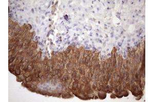 Immunohistochemistry (IHC) image for anti-Amelotin (AMTN) antibody (ABIN2716038)