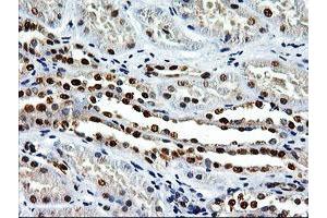 Image no. 2 for anti-EPM2A (Laforin) Interacting Protein 1 (EPM2AIP1) antibody (ABIN1498046) (EPM2AIP1 anticorps)