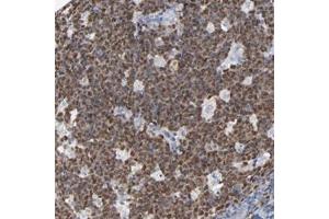 Immunohistochemical staining of human tonsil with BIRC3 polyclonal antibody  shows nuclear positivity in reaction center cells at 1:50-1:200 dilution. (BIRC3 anticorps)