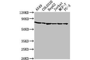 Western Blot Positive WB detected in: A549 whole cell lysate, COLO320 whole cell lysate, HepG2 whole cell lysate, Jurkat whole cell lysate, MCF-7 whole cell lysate, PC-3 whole cell lysate All lanes: HSPA1A antibody at 1:2000 Secondary Goat polyclonal to rabbit IgG at 1/50000 dilution Predicted band size: 71, 64 kDa Observed band size: 71 kDa (HSP70 1A anticorps  (AA 291-641))