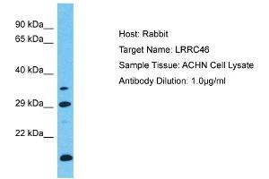 Host: Rabbit Target Name: LRRC46 Sample Type: ACHN Whole Cell lysates Antibody Dilution: 1. (LRRC46 anticorps  (C-Term))