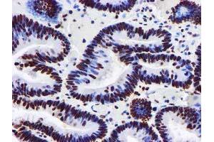 Image no. 5 for anti-Glutathione S-Transferase theta 2 (GSTT2) antibody (ABIN1498553) (GSTT2 anticorps)