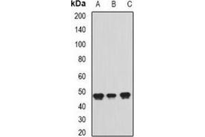 Western blot analysis of ADE2 expression in Jurkat (A), Raji (B), Hela (C) whole cell lysates. (PAICS anticorps)