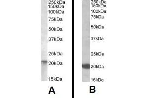 Western Blotting (WB) image for anti-GTPase NRas (NRAS) (Internal Region) antibody (ABIN2466026)