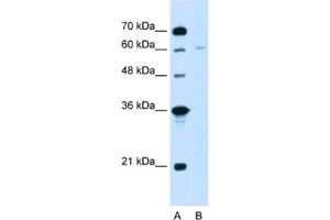 Western Blotting (WB) image for anti-Chromatin Assembly Factor 1, Subunit B (p60) (CHAF1B) antibody (ABIN2462905) (CHAF1B anticorps)