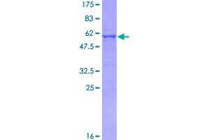 Image no. 1 for Histone Deacetylase 7 (HDAC7) (AA 1-276) protein (GST tag) (ABIN1306462)