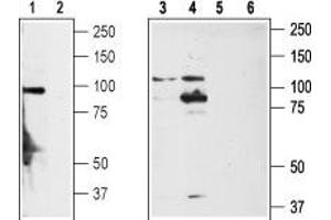 Western blot analysis of rat DRG (lanes 1,2), non-differentiated PC12 cells (lanes 3,5) and differentiated PC12 cells (lanes 4,6) lysates: - 1,3,4. (TRPA1 anticorps  (1st Extracellular Loop))