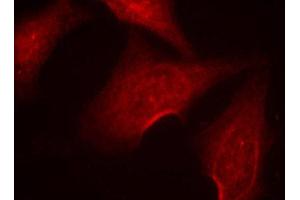 Immunofluorescence (IF) image for anti-Nuclear Factor-kB p65 (NFkBP65) (pSer311) antibody (ABIN1870583) (NF-kB p65 anticorps  (pSer311))