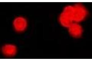 Immunofluorescent analysis of PPP2R4 staining in MCF7 cells.