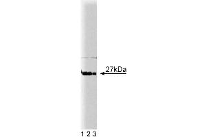 Western blot analysis of p27[Kip1] on HeLa cell lysate. (CDKN1B anticorps  (AA 1-197))