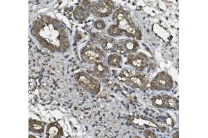 IHC analysis of ULBP1 using anti ULBP1 antibody (ABIN7600996). (ULBP1 anticorps  (AA 27-209))