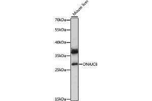 Western blot analysis of extracts of mouse liver, using DN antibody (ABIN7266829) at 1:1000 dilution.