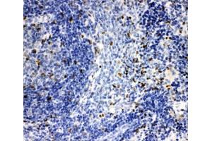 IHC-P: IRAK2 antibody testing of rat spleen tissue