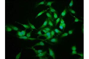 Immunofluorescence staining of Hela cells with ABIN7142099 at 1:225, counter-stained with DAPI.
