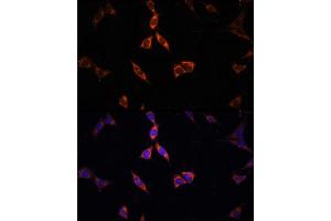 Immunofluorescence analysis of NIH-3T3 cells using  Rabbit pAb (ABIN6131387, ABIN6136467, ABIN6136469 and ABIN6222130) at dilution of 100 (40x lens).
