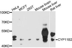 Western blot analysis of extracts of various cells，using CYP11B2 antibody. (CYP11B2 anticorps)